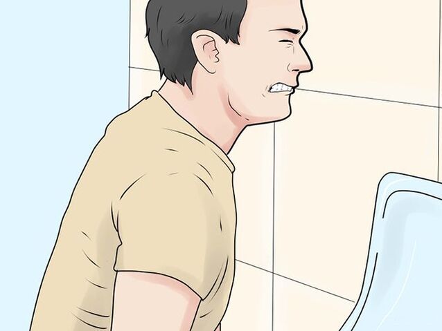 dolore durante la minzione a causa della prostatite